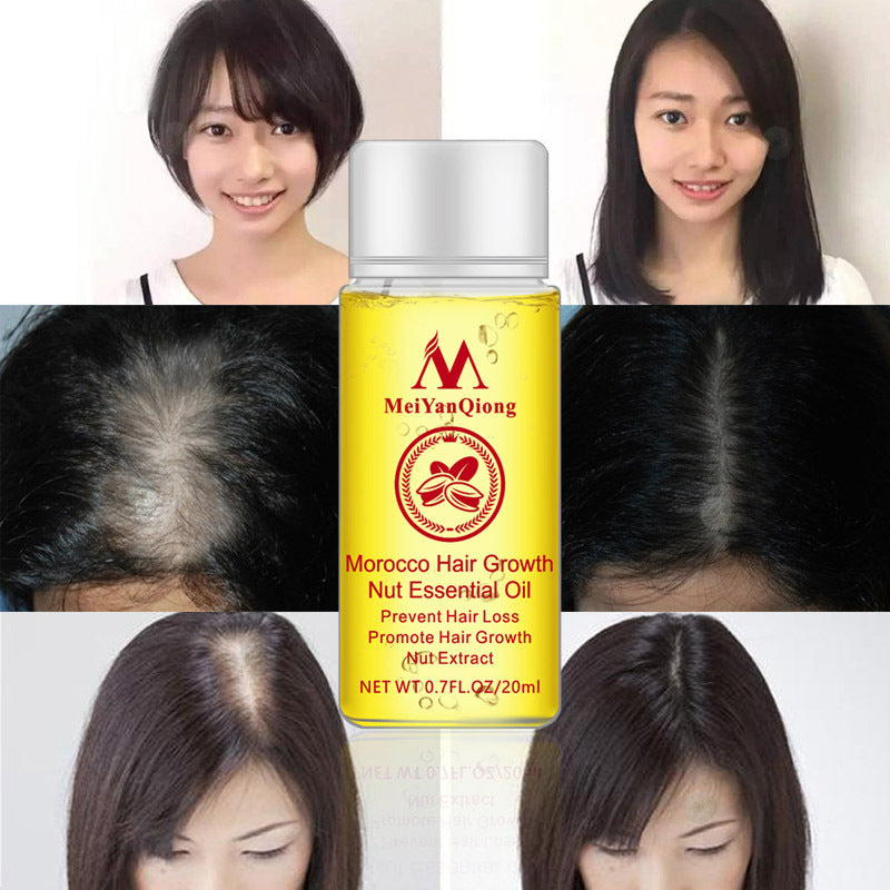 Hair Loss Treatments Hair Starch OilPerfect after keratin