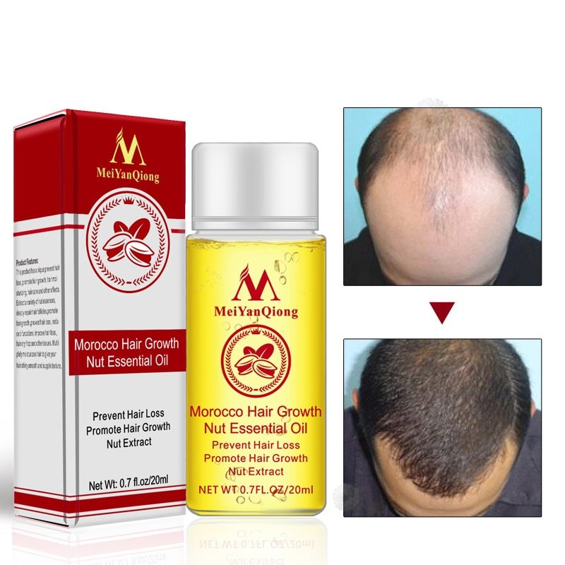 Hair Loss Treatments Hair Starch OilPerfect after keratin