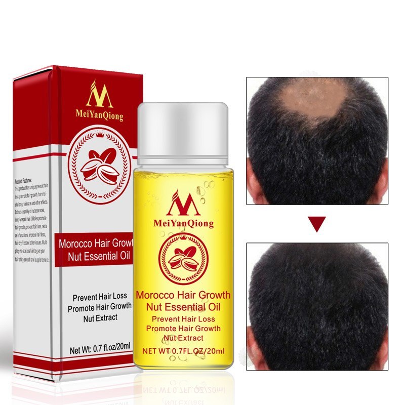Hair Loss Treatments Hair Starch OilPerfect after keratin