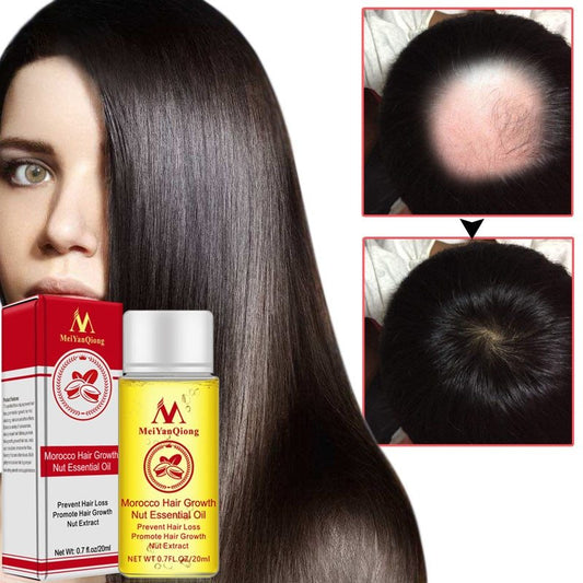 Hair Loss Treatments Hair Starch OilPerfect after keratin